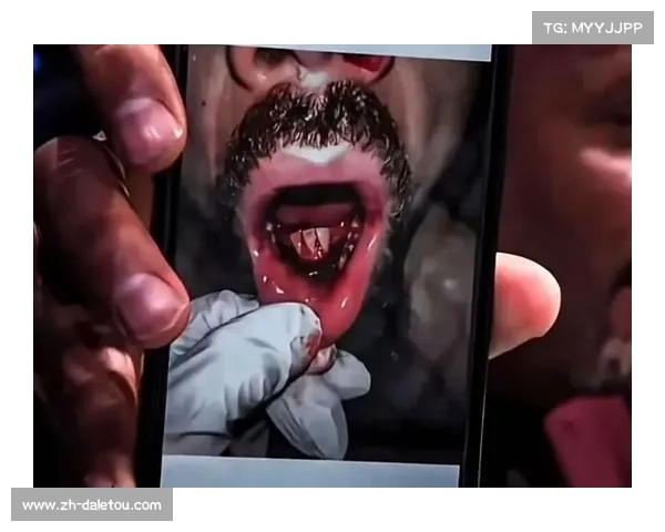 奇马耶夫中量级夺冠后计划手术,UFC中量级进入狼王时代